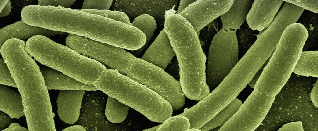 higiene en la cocina, bacterias